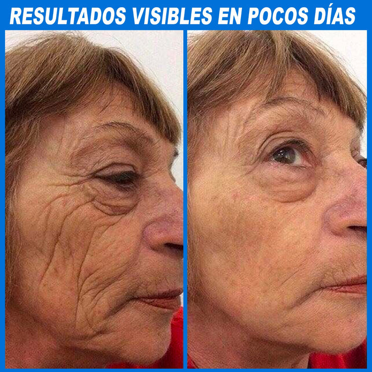 SERUM BOTOXPRO™ CON COLAGENO