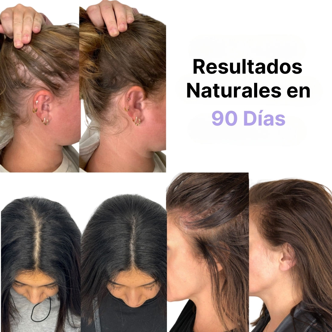 HairGlow Pro® Cepillo Masajeador Eléctrico anticaídas