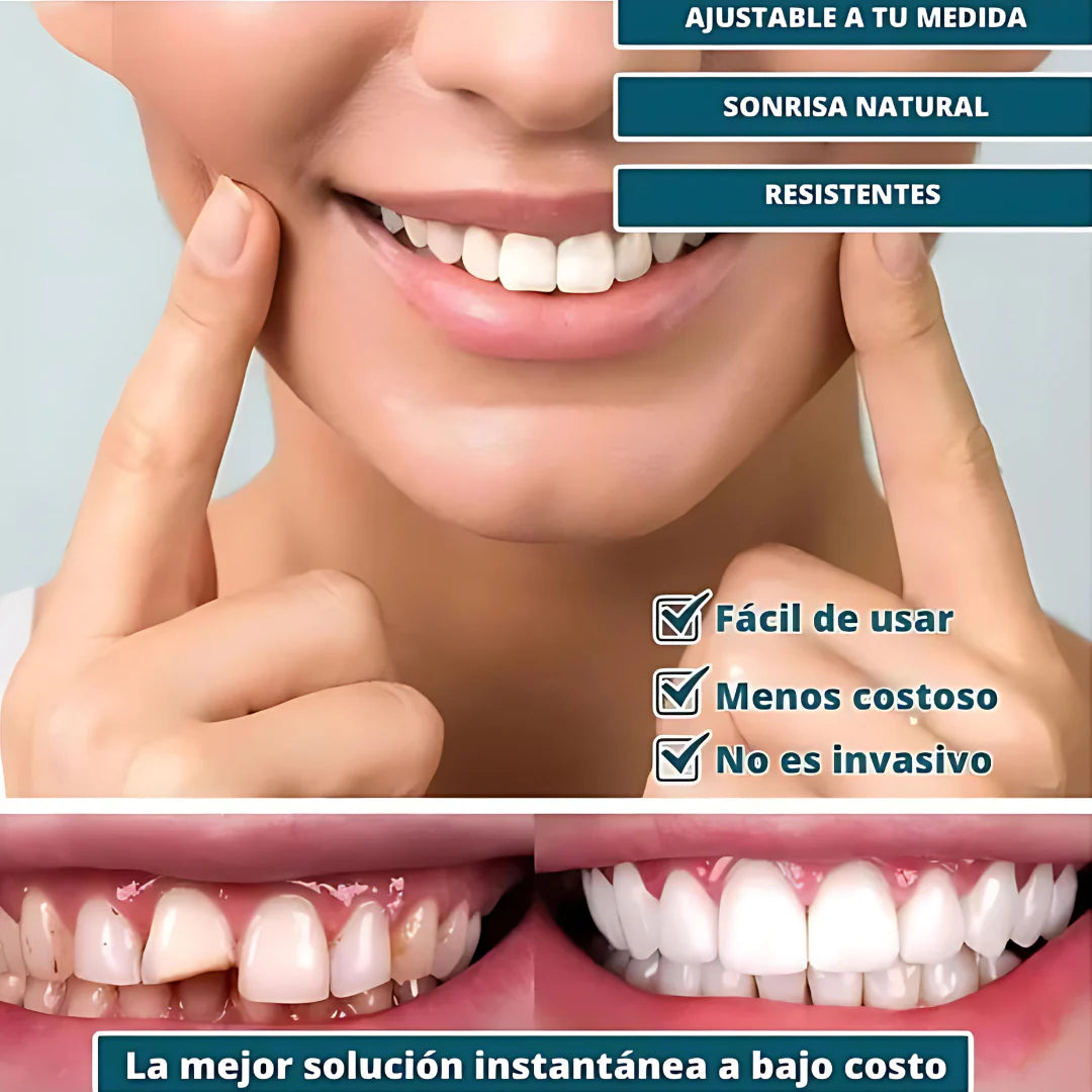 PerfectSmile Pro - Carillas Dentales Ajustables